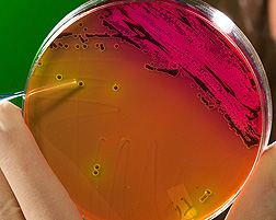 Salmonella colony on an agar plate. Link to photo information